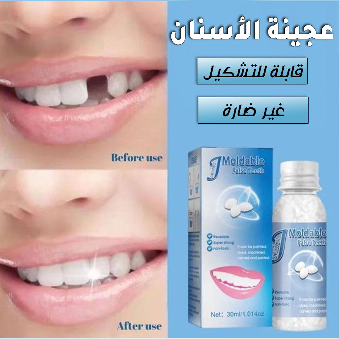 حبيبات لاصلاح الاسنان